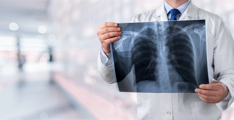 what is fibrous mesothelioma